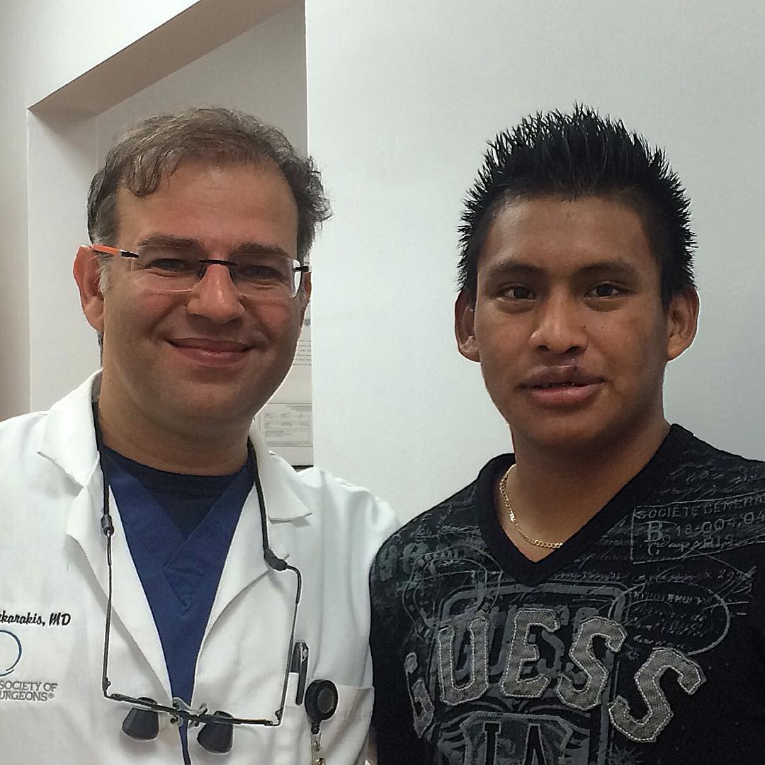 Cleft Lip Surgery Miami